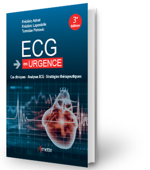 Image sur ECG en urgence Cas clinique - Analyse ECG - Stratégie thérapeutique