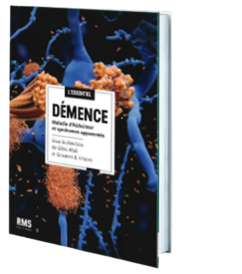 Image sur Démence : L'essentiel
